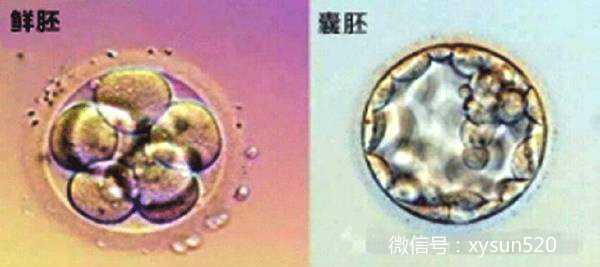 广州代怀靠谱机构,要不要养囊？广州试管囊胚移植的5个理由